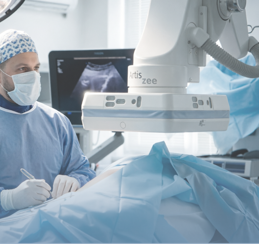 Ангиография