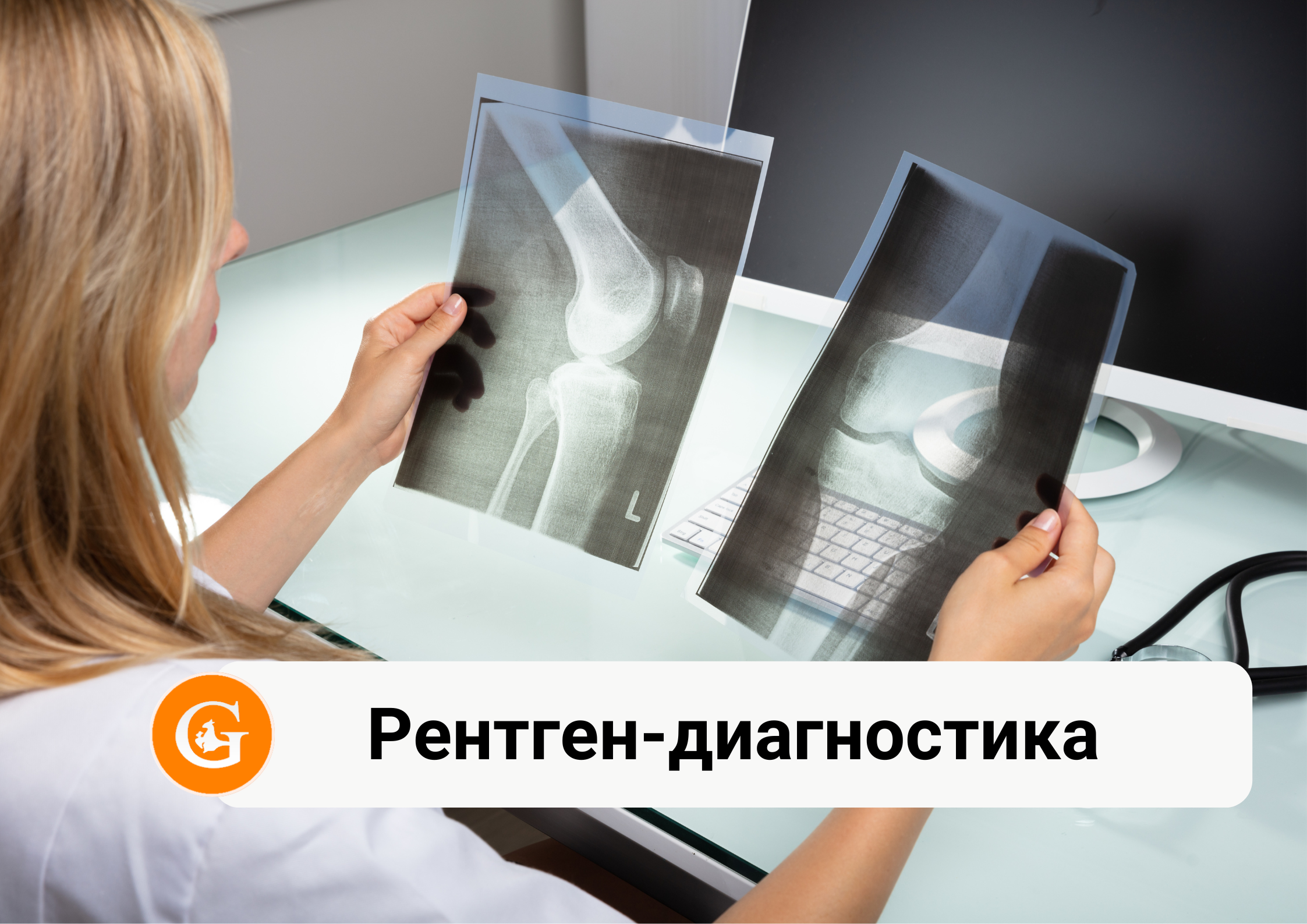 Рентген-диагностика костной и суставной системы
