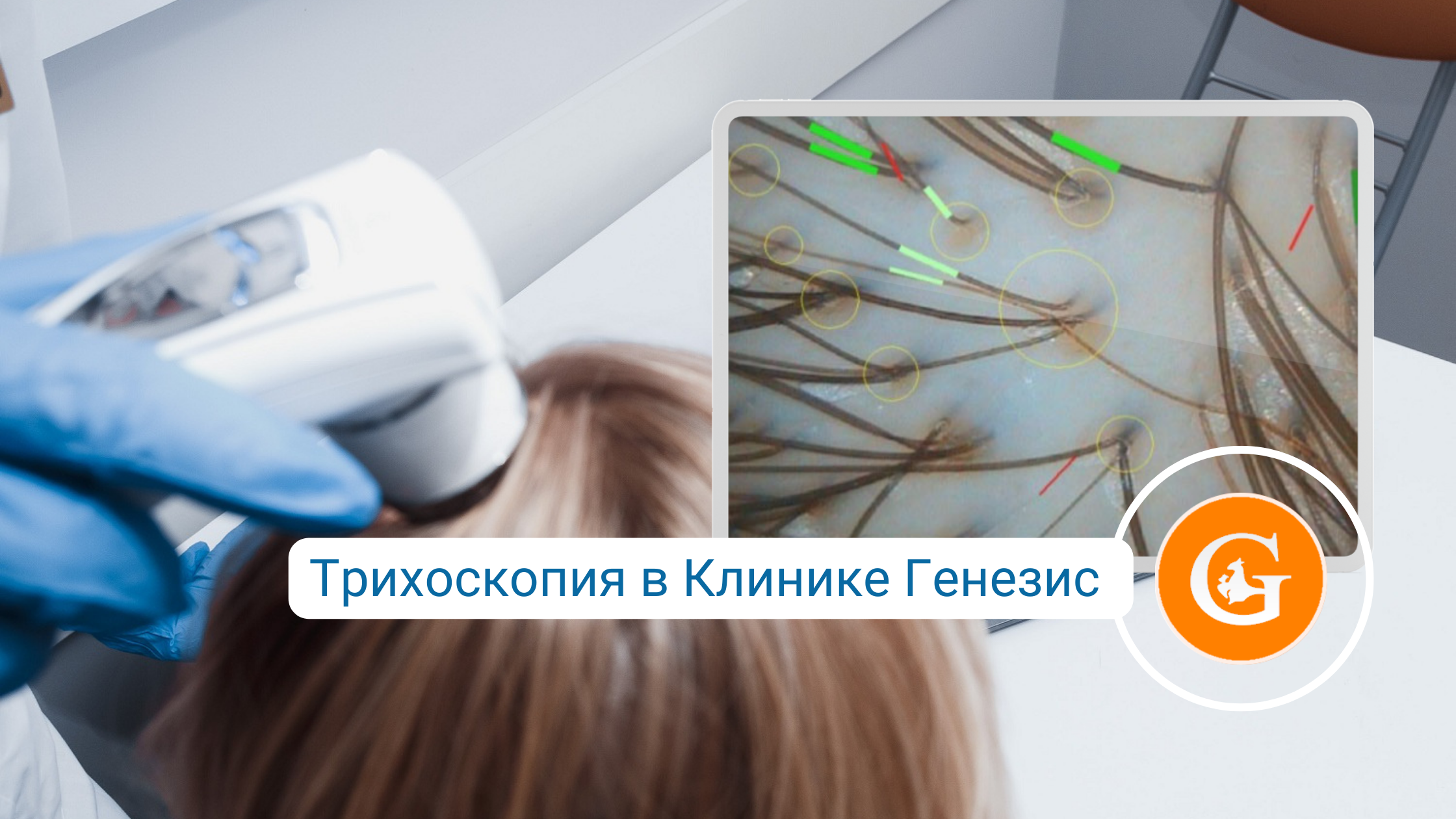 Трихоскопия волос (компьютерная диагностика волос)